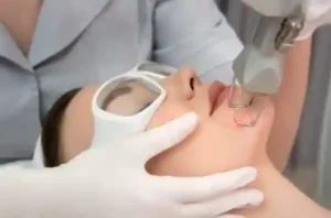 laser resurfacing bogota